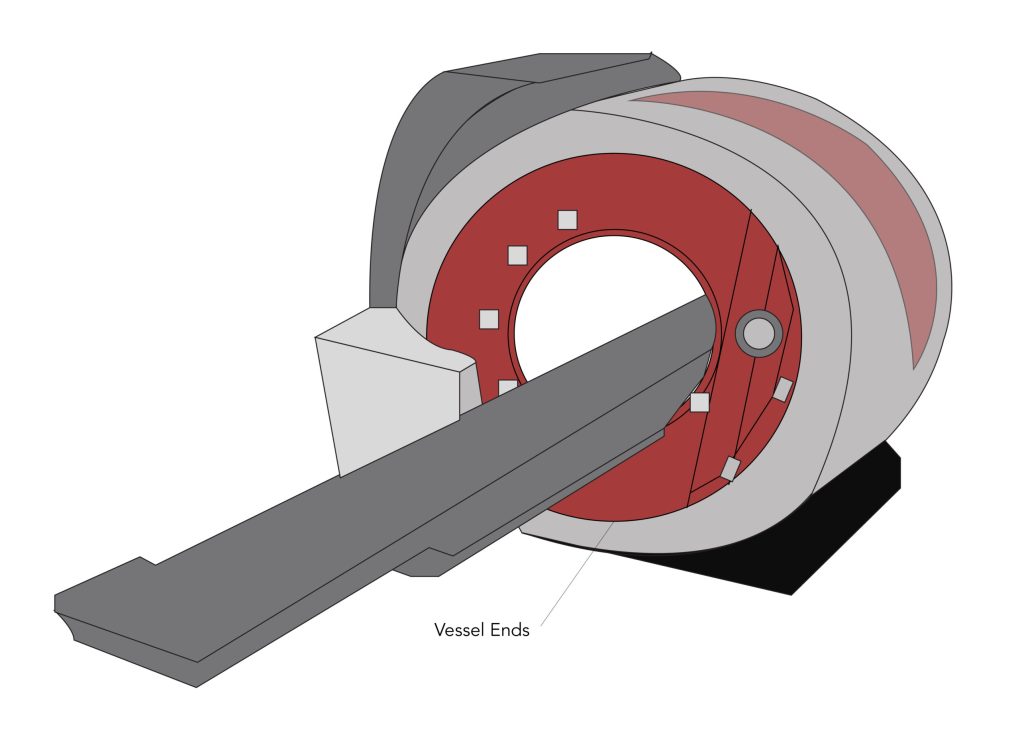 Metal Spun MRI Scanner Vessel Ends